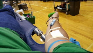 arm giving blood